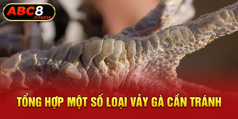 Tổng hợp một số loại vảy gà cần tránh